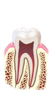 Root canal animation